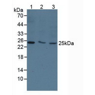Thymidine Kinase 1, Soluble (TK1) Human Polyclonal Antibody