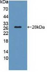 Thyroid Stimulating Hormone Receptor (TSHR) Rat Polyclonal Antibody