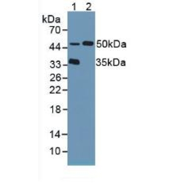 Tripeptidyl Peptidase I (TPP1) Human Polyclonal Antibody