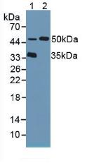 Tripeptidyl Peptidase I (TPP1) Human Polyclonal Antibody