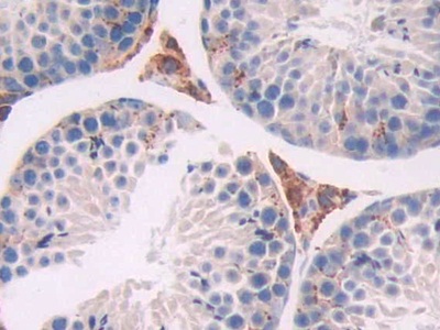 Tripeptidyl Peptidase I (TPP1) Mouse Polyclonal Antibody