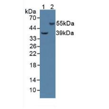 Adenylyl Cyclase Associated Protein 2 (CAP2) Human Polyclonal Antibody