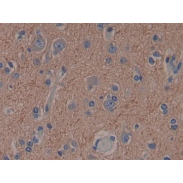 Adenylyl Cyclase Associated Protein 2 (CAP2) Human Polyclonal Antibody