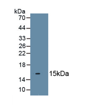 Twist Transcription Factor (TWIST) Human Polyclonal Antibody