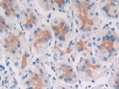 Secreted Frizzled Related Protein 5 (SFRP5) Human Polyclonal Antibody