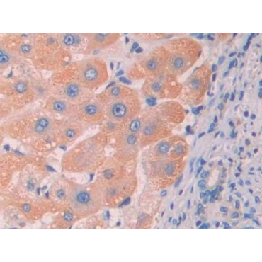 Renalase (RNLS) Human Polyclonal Antibody