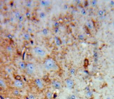 Renalase (RNLS) Rat Polyclonal Antibody