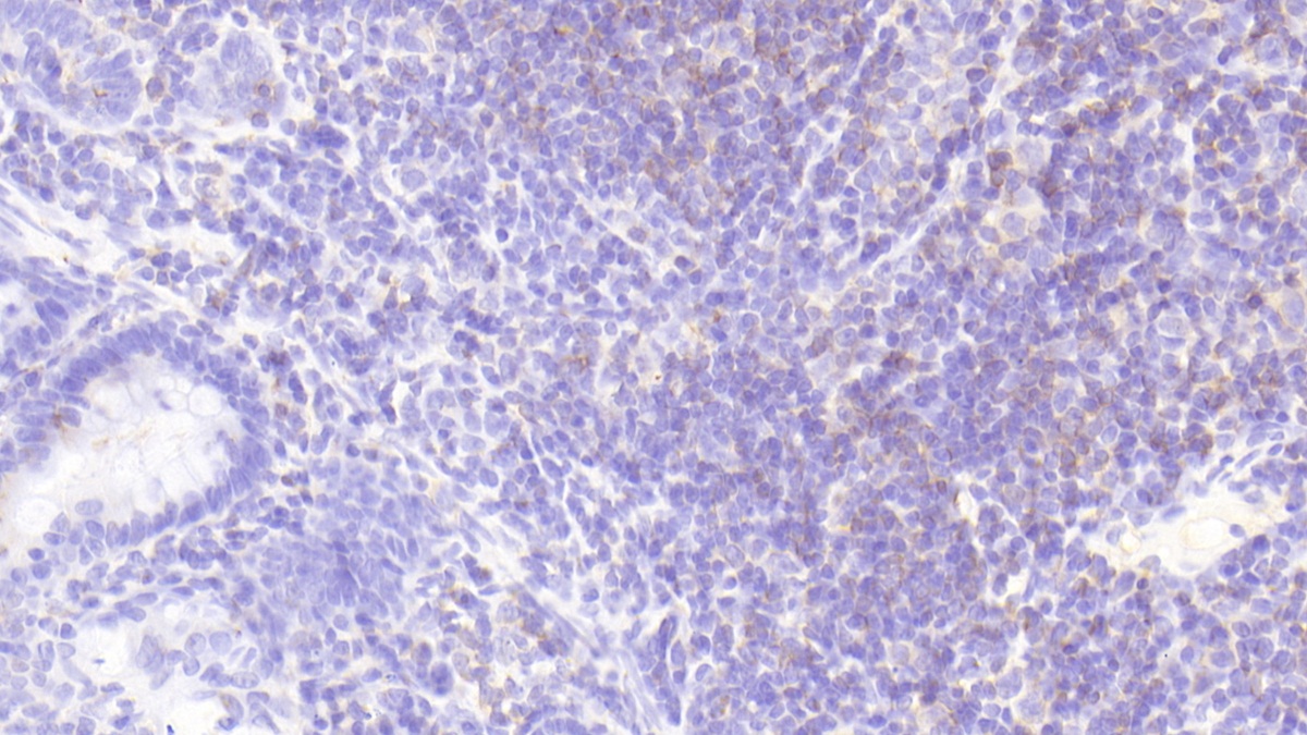 Src Kinase Associated Phosphoprotein 1 (SKAP1) Rat Polyclonal Antibody