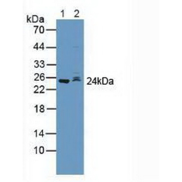 S-Phase Kinase Associated Protein 2 (SKP2) Human Polyclonal Antibody