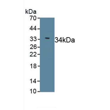 Sarcolipin (SLN) Human Polyclonal Antibody