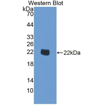 Spermine Oxidase (SMOX) Human Polyclonal Antibody