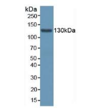 Aminoadipate Semialdehyde Synthase (AASS) Human Polyclonal Antibody