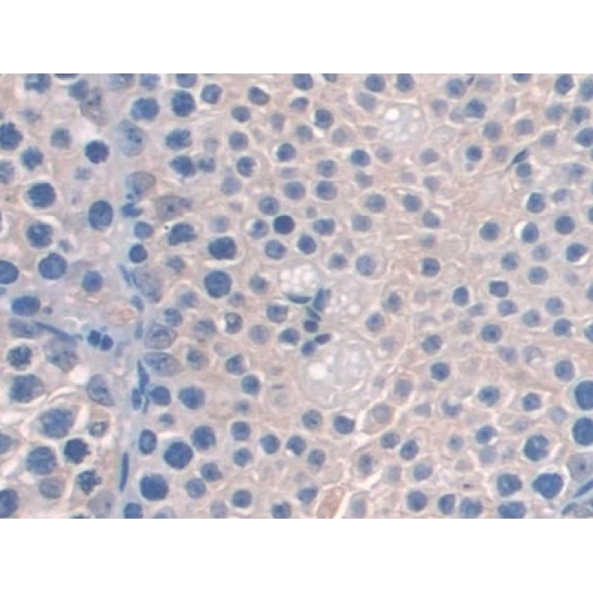 Aminoadipate Semialdehyde Synthase (AASS) Mouse Polyclonal Antibody