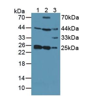 Synaptosomal Associated Protein 23kDa (SNAP23) Human Polyclonal Antibody