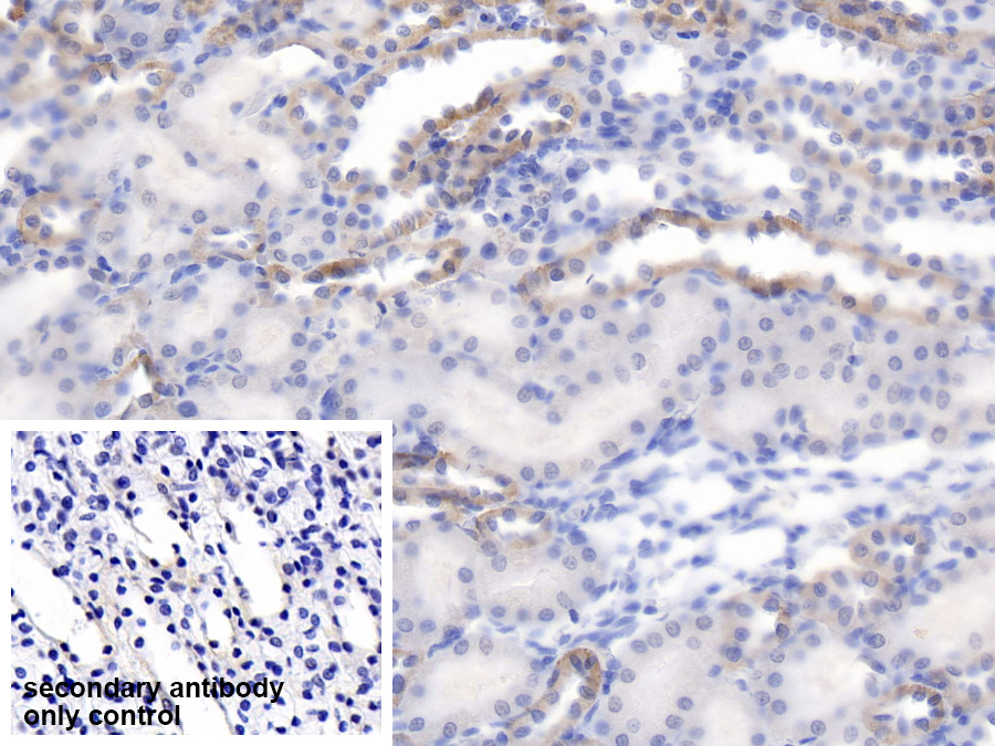 Synuclein Alpha Interacting Protein 1 (SNCaIP1) Rat Polyclonal Antibody