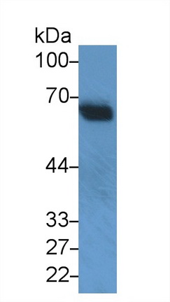 Snurportin 1 (SNUPN1) Human Polyclonal Antibody