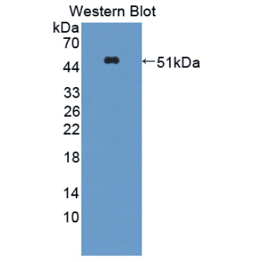 Sclerostin (SOST) Human Polyclonal Antibody