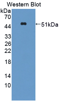 Sclerostin (SOST) Human Polyclonal Antibody
