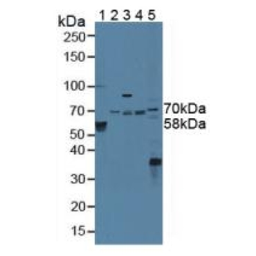 Signal Transducing Adaptor Molecule 2 (STAM2) Human Polyclonal Antibody