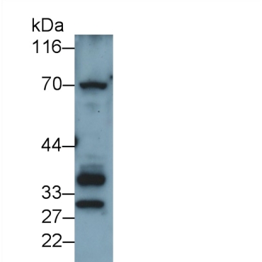 Sulfatase Modifying Factor 1 (SUMF1) Human Polyclonal Antibody