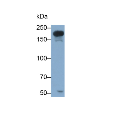 Supervillin (SVIL) Human Polyclonal Antibody