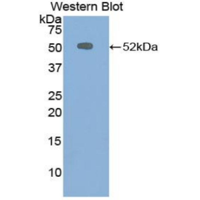 Chromogranin B (CHGB) Bovine (Cattle) Polyclonal Antibody