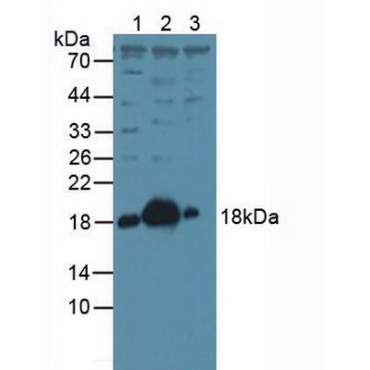 Stathmin 1 (STMN1) Human Polyclonal Antibody