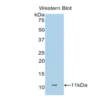 Dermcidin (DCD) Human Polyclonal Antibody