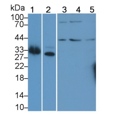 Deoxyhypusine Synthase (DHPS) Human Polyclonal Antibody