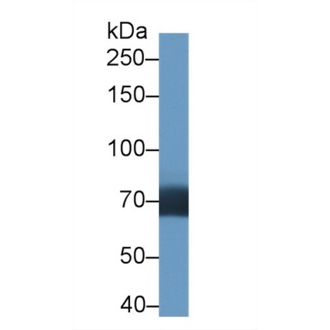Death Inducer Obliterator 1 (DIDO1) Human Polyclonal Antibody