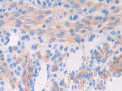 Glutamate Decarboxylase 1, Brain (GAD1) Mouse Polyclonal Antibody