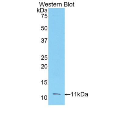 Fibroblast Growth Factor 3 (FGF3) Human Polyclonal Antibody