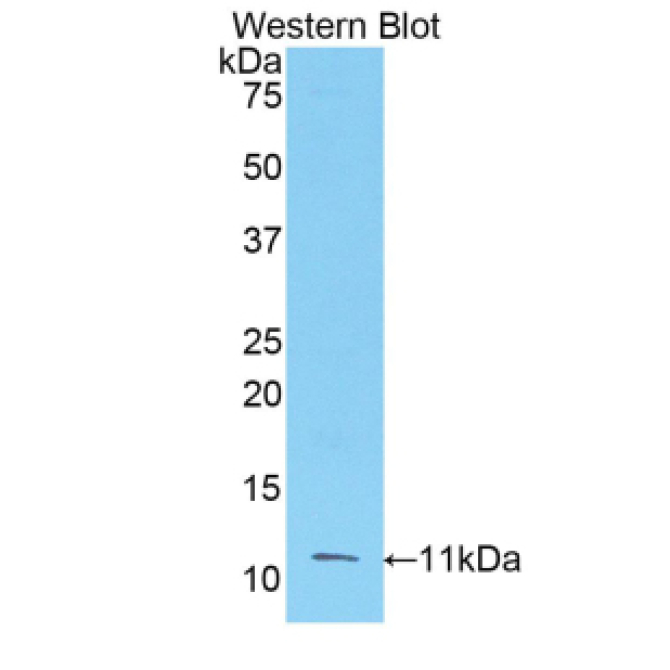 Fibroblast Growth Factor 3 (FGF3) Human Polyclonal Antibody