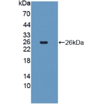 Fibroblast Growth Factor 18 (FGF18) Human Polyclonal Antibody