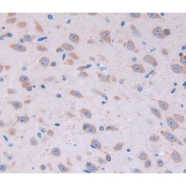 Fibroblast Growth Factor 22 (FGF22) Mouse Polyclonal Antibody