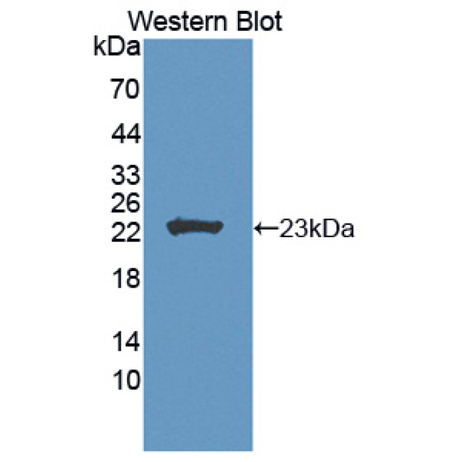 Fibroblast Growth Factor 11 (FGF11) Human Polyclonal Antibody