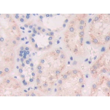 Fibroblast Growth Factor 19 (FGF19) Human Polyclonal Antibody