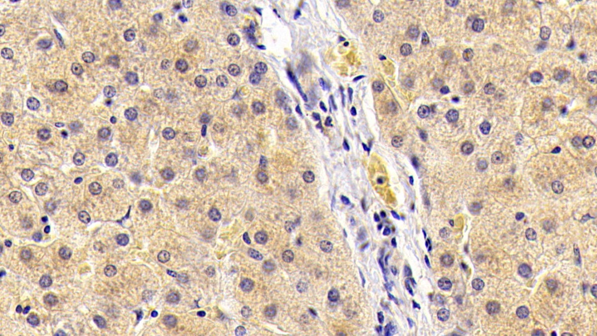 Fibroblast Growth Factor 21 (FGF21) Pig Polyclonal Antibody