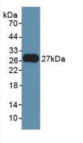 Fibroblast Growth Factor 21 (FGF21) Rat Polyclonal Antibody