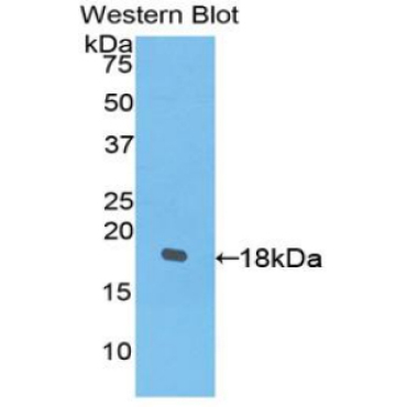 Platelet Derived Growth Factor C (PDGFC) Human Polyclonal Antibody