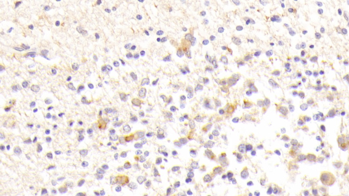 Platelet Derived Growth Factor Subunit B (PDGFB) Human Polyclonal Antibody