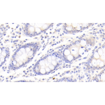 Platelet Derived Growth Factor Receptor Like Protein (PDGFRL) Human Polyclonal Antibody