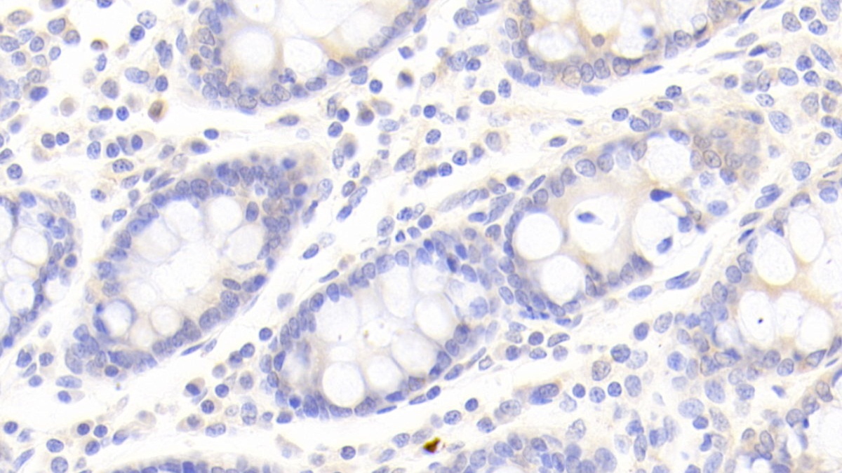 Platelet Derived Growth Factor Receptor Like Protein (PDGFRL) Human Polyclonal Antibody