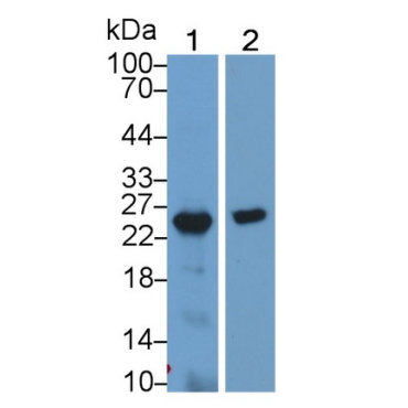 Growth Hormone 2 (GH2) Human Polyclonal Antibody