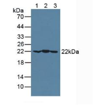 Crystallin Alpha B (CRYaB) Human Polyclonal Antibody