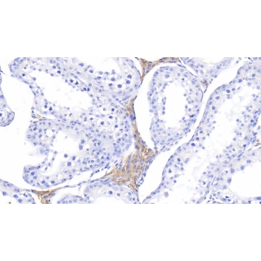 Melatonin Receptor 1A (MTNR1A) Bovine (Cattle) Polyclonal Antibody