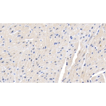 Melanin Concentrating Hormone Receptor 1 (MCHR1) Human Polyclonal Antibody