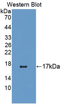 Cannabinoid Receptor 1, Brain (CNR1) Rat Polyclonal Antibody
