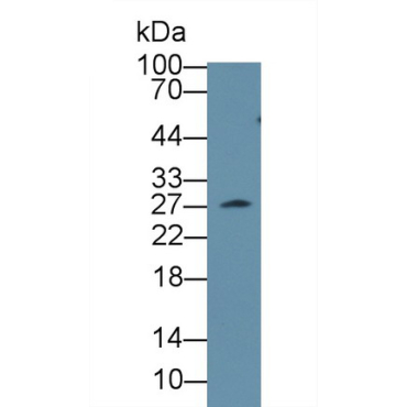 Clathrin, Light Polypeptide A (CLTA) Mouse Polyclonal Antibody