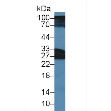 Synaptosomal Associated Protein 25kDa (SNAP25) Human Polyclonal Antibody